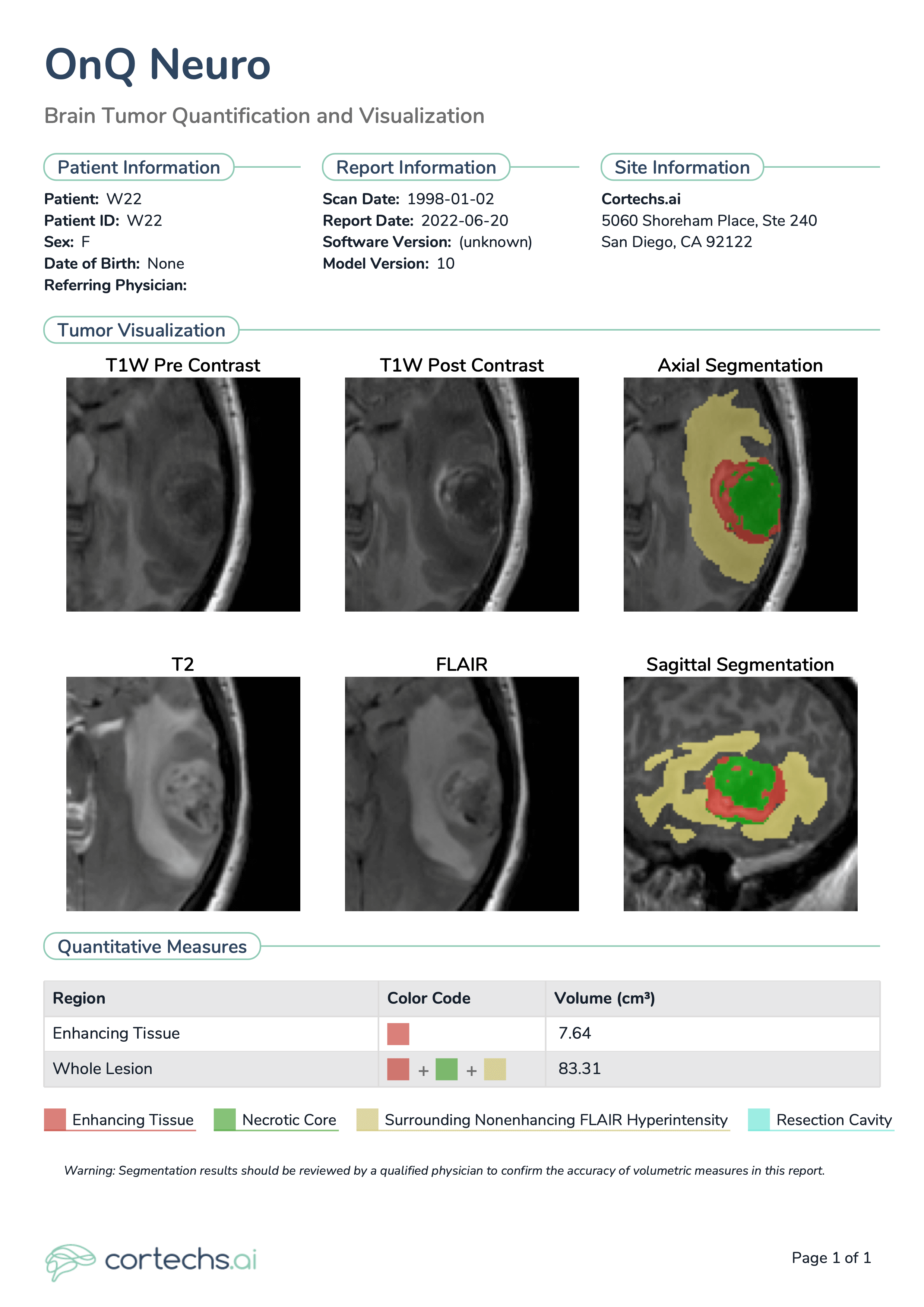 OnQ Neuro: Case Study - Cortechs.ai