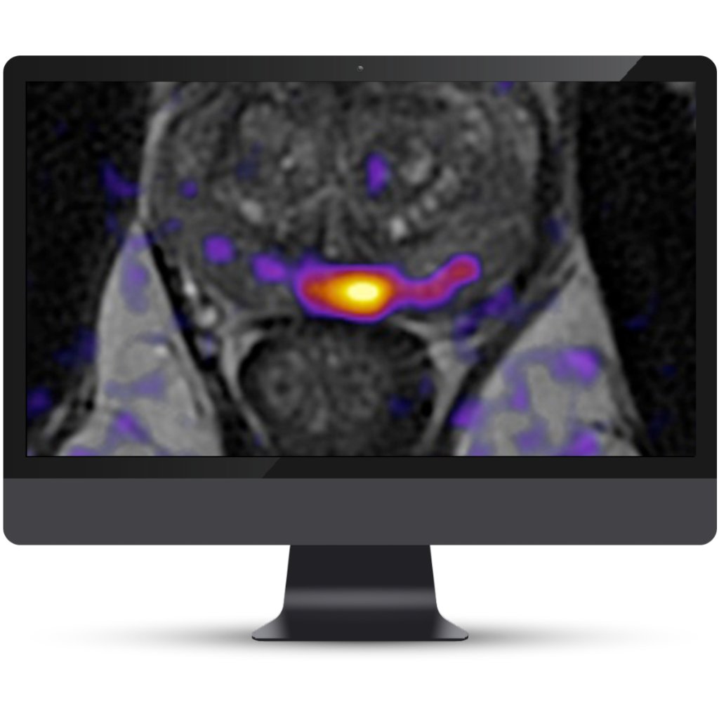 Cortechs.ai|Understanding CPT Codes for Prostate MRI Analysis