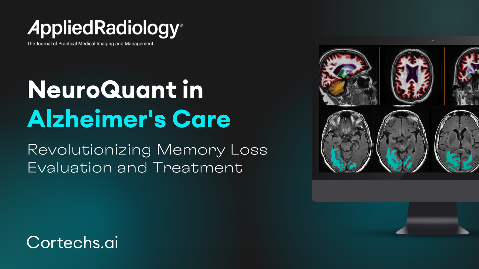 Cortechs.ai | Unlocking the Power of AI Imaging in Multiple Sclerosis: How NeuroQuant® MS Enhances Lesion Detection and Monitoring