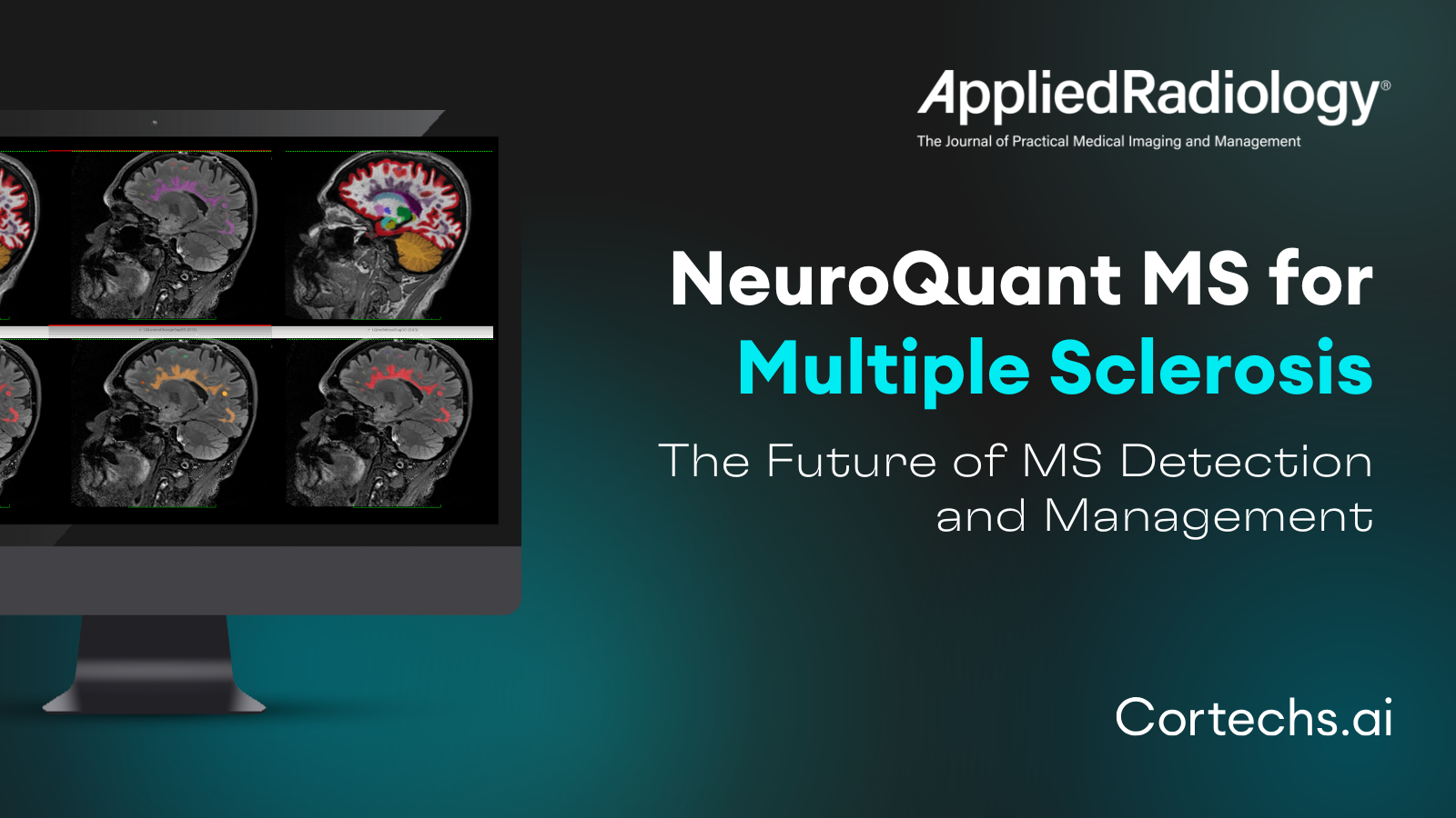 Cortechs.ai | NeuroQuant® MS:  Advancing Precision in Multiple Sclerosis