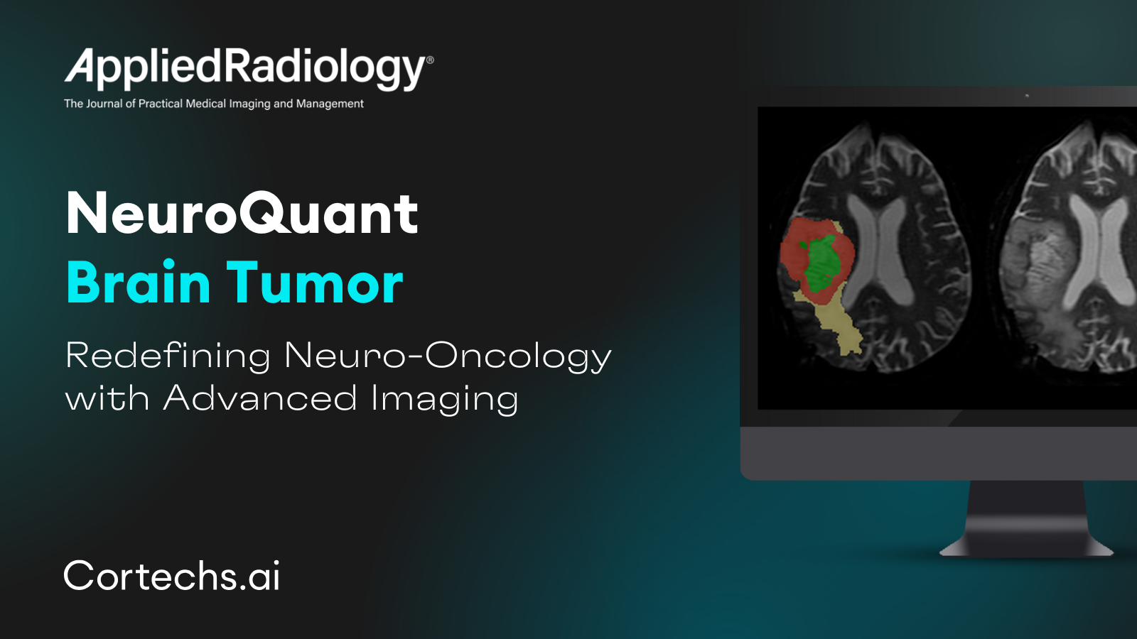 Cortechs.ai | NeuroQuant Brain Tumor